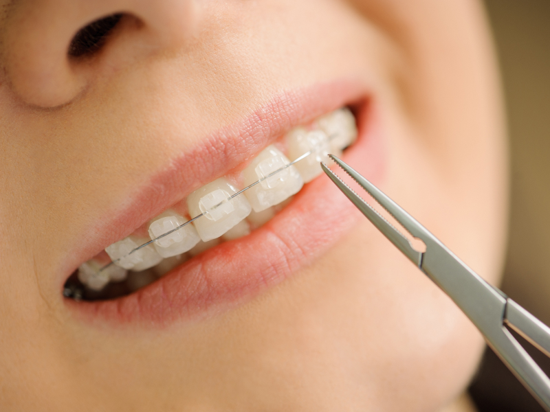 矯正歯科・小児矯正歯科